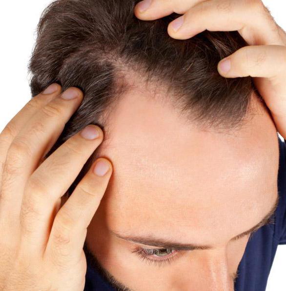 बालों के लिए ओजोन थेरेपी: प्रक्रिया, संकेत, समीक्षा का विवरण