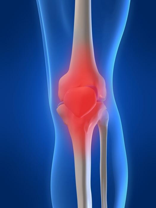 संयुक्त दर्द होता है मुझे क्या करना चाहिए?