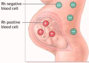 भ्रूण के आरएच फैक्टर का निर्धारण