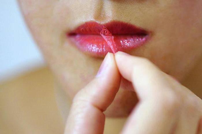 फड़फड़ा हुआ होंठ: कारण और इलाज के तरीकों